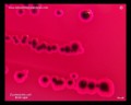 escherichia coli